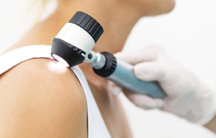 About Skin Cancer