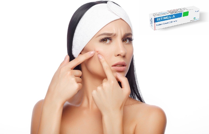 About Tretinoin