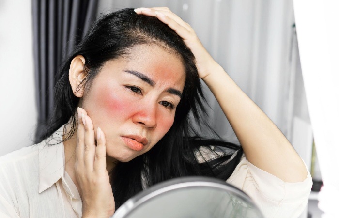Skin Changes During a Sunburn