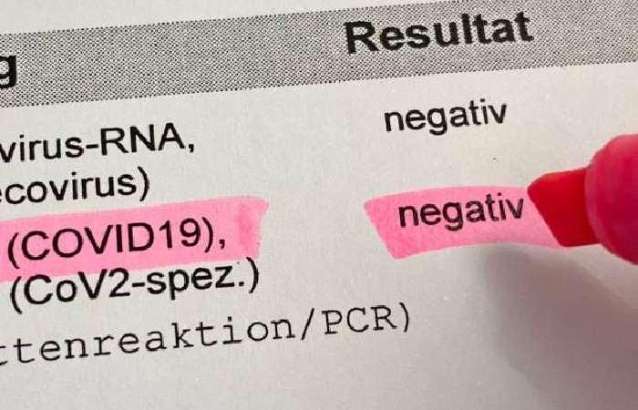 Points for Negative Covid Test Results Template
